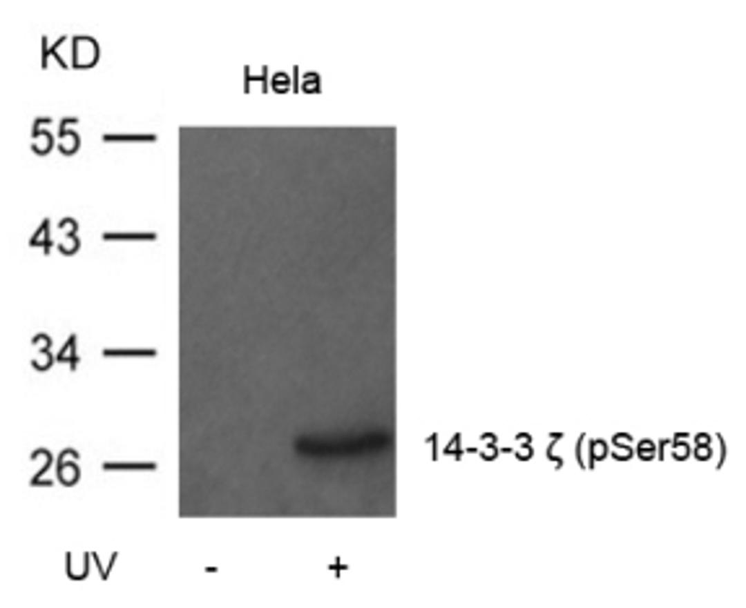 Western blot analysis of lysed extracts from HeLa cells untreated or treated with UV using 14-3-3 zeta (Phospho-Ser58).