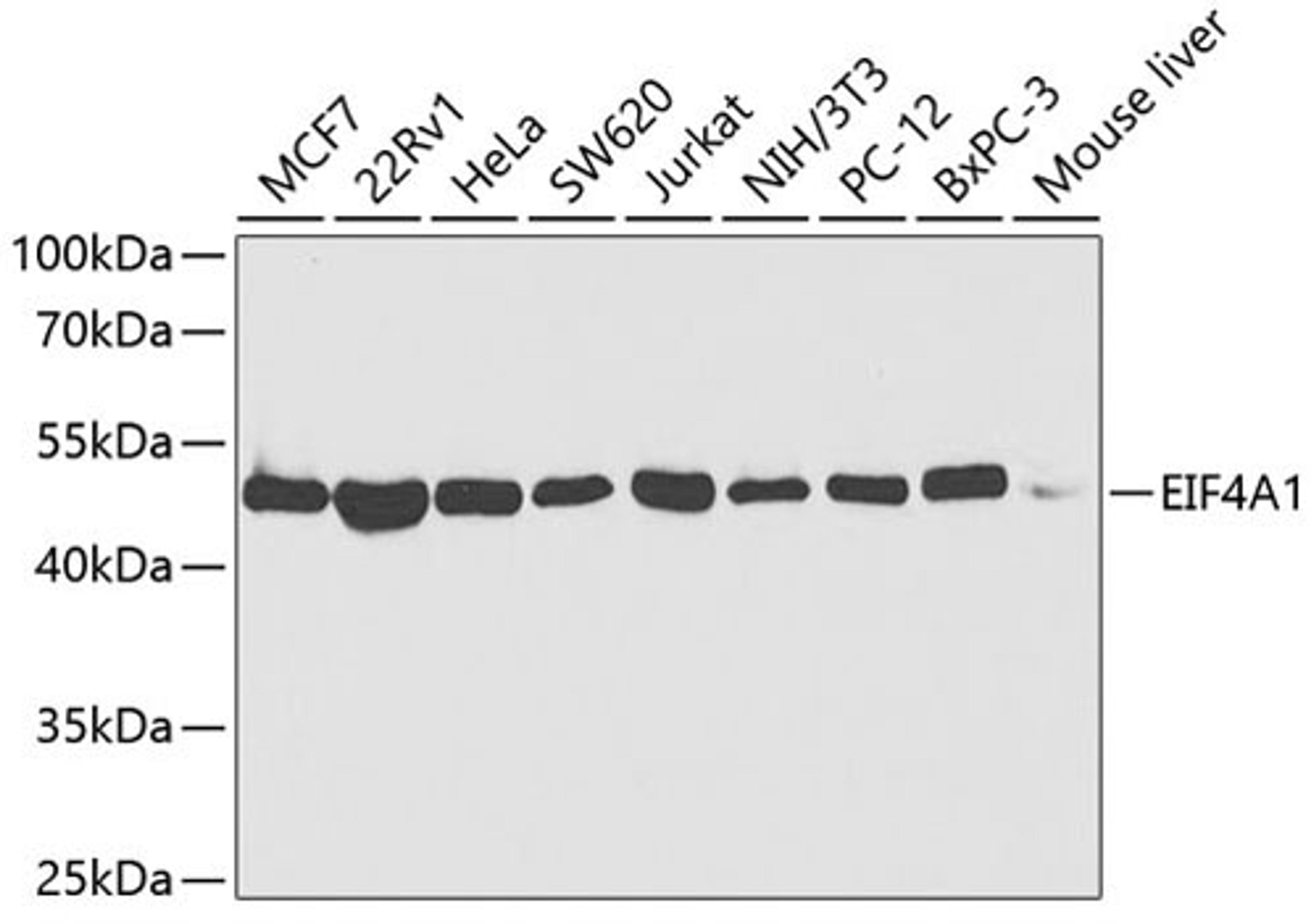 Western blot - EIF4A1 antibody (A5294)