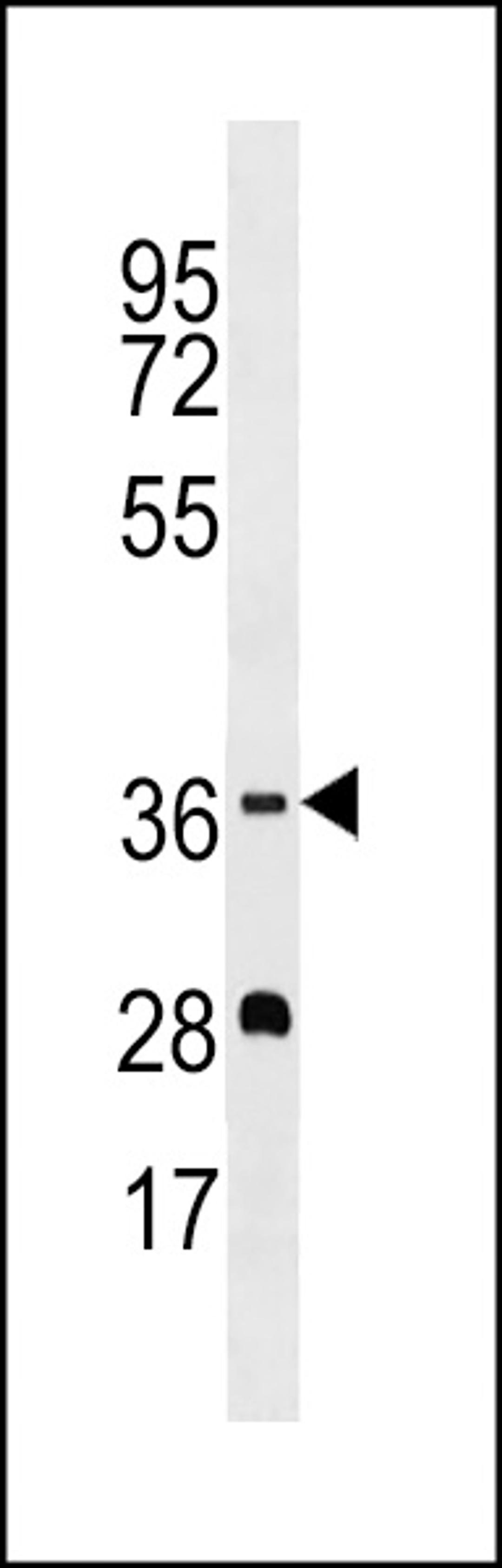 Western blot analysis in MDA-MB453 cell line lysates (35ug/lane).