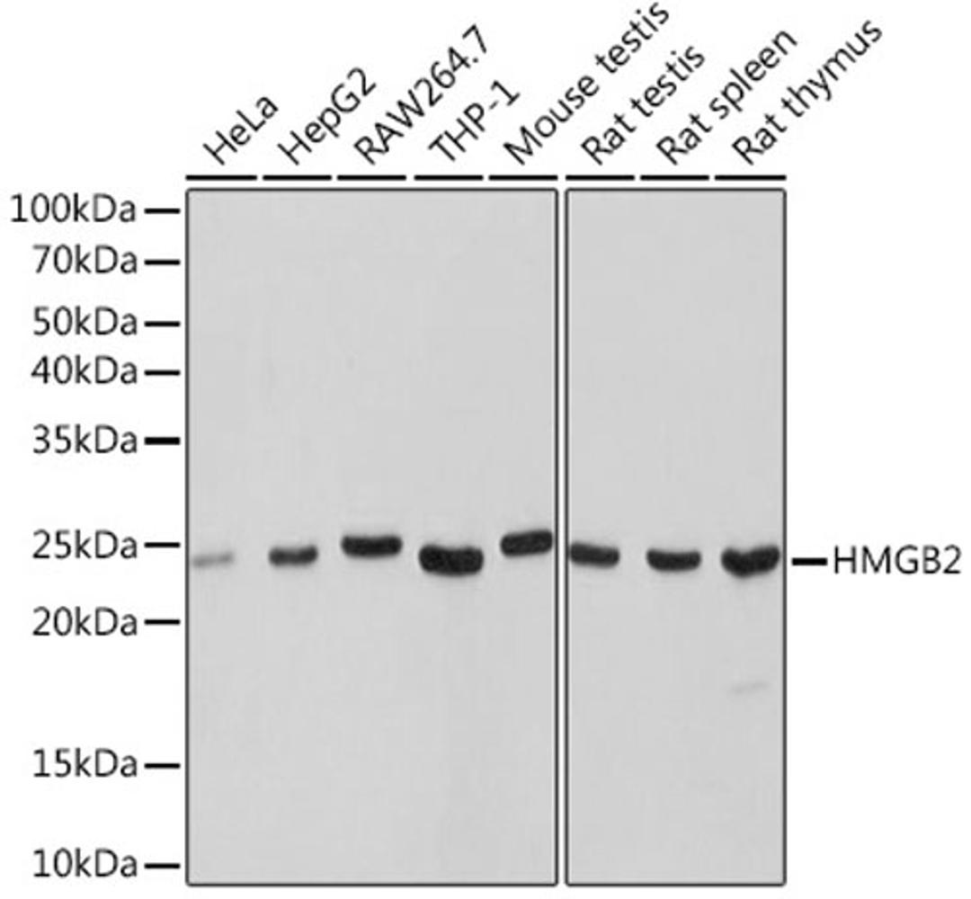 Western blot - HMGB2 Rabbit mAb (A9168)