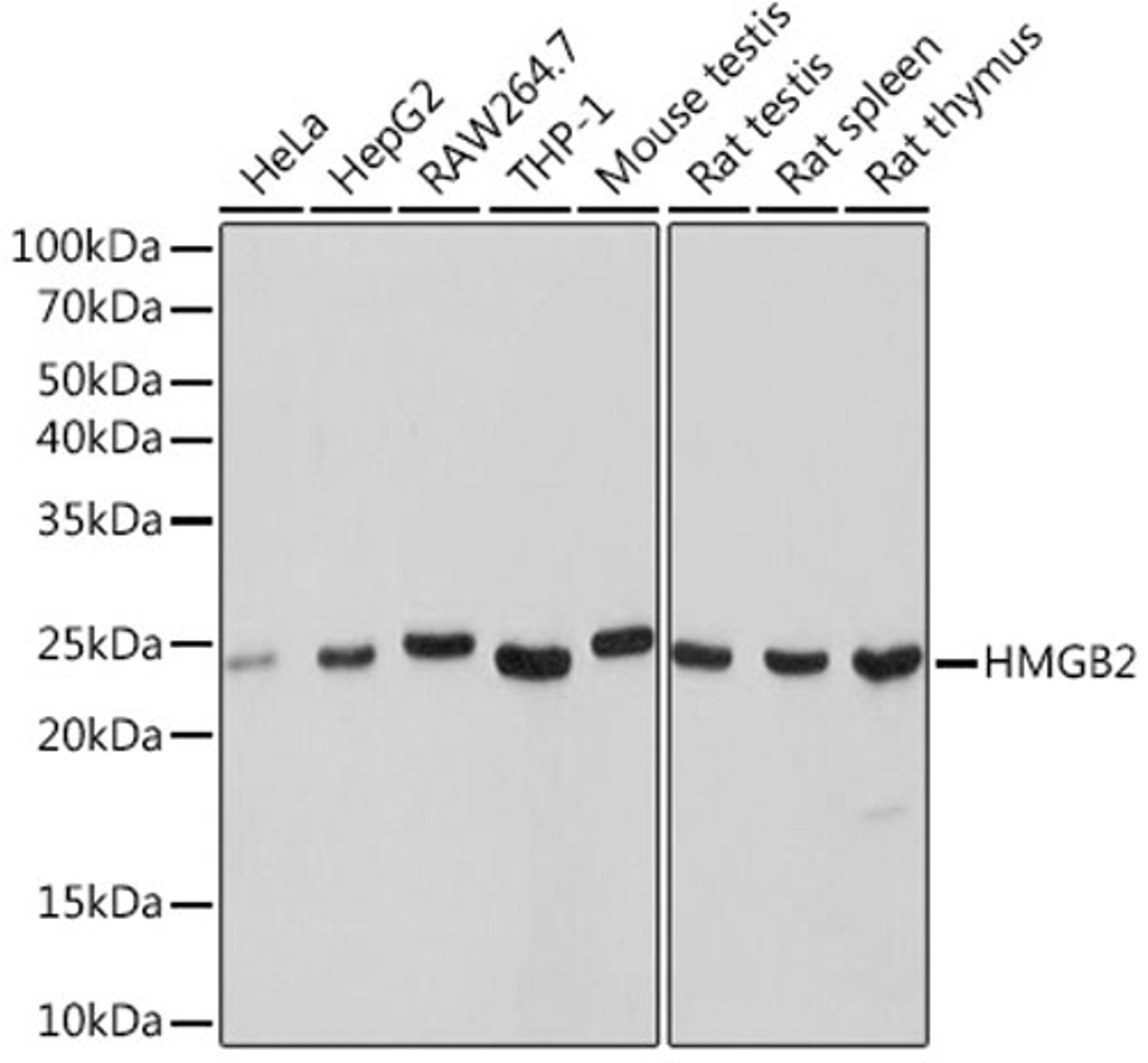 Western blot - HMGB2 Rabbit mAb (A9168)