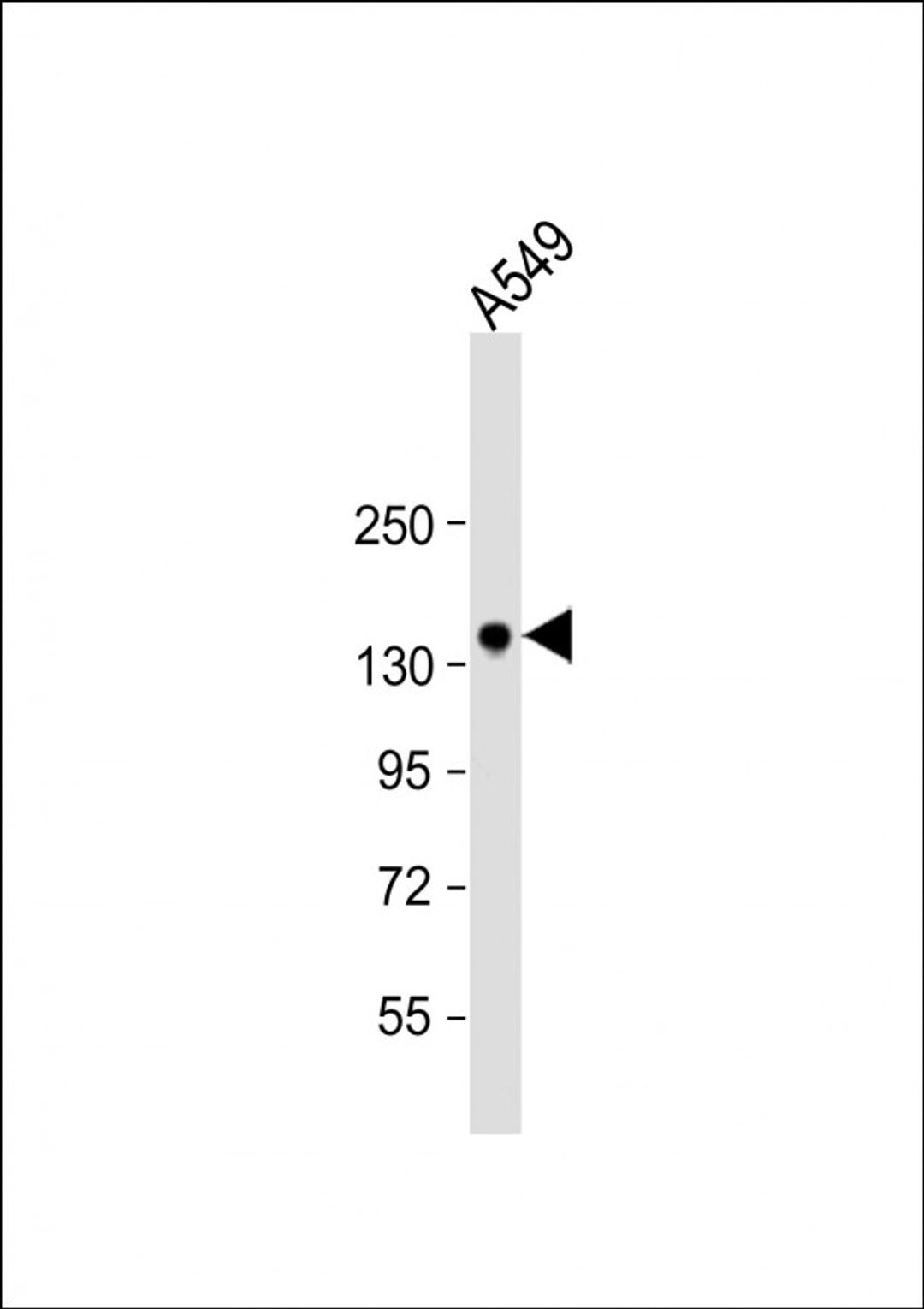 Western Blot at 1:1000 dilution + A549 whole cell lysate Lysates/proteins at 20 ug per lane.