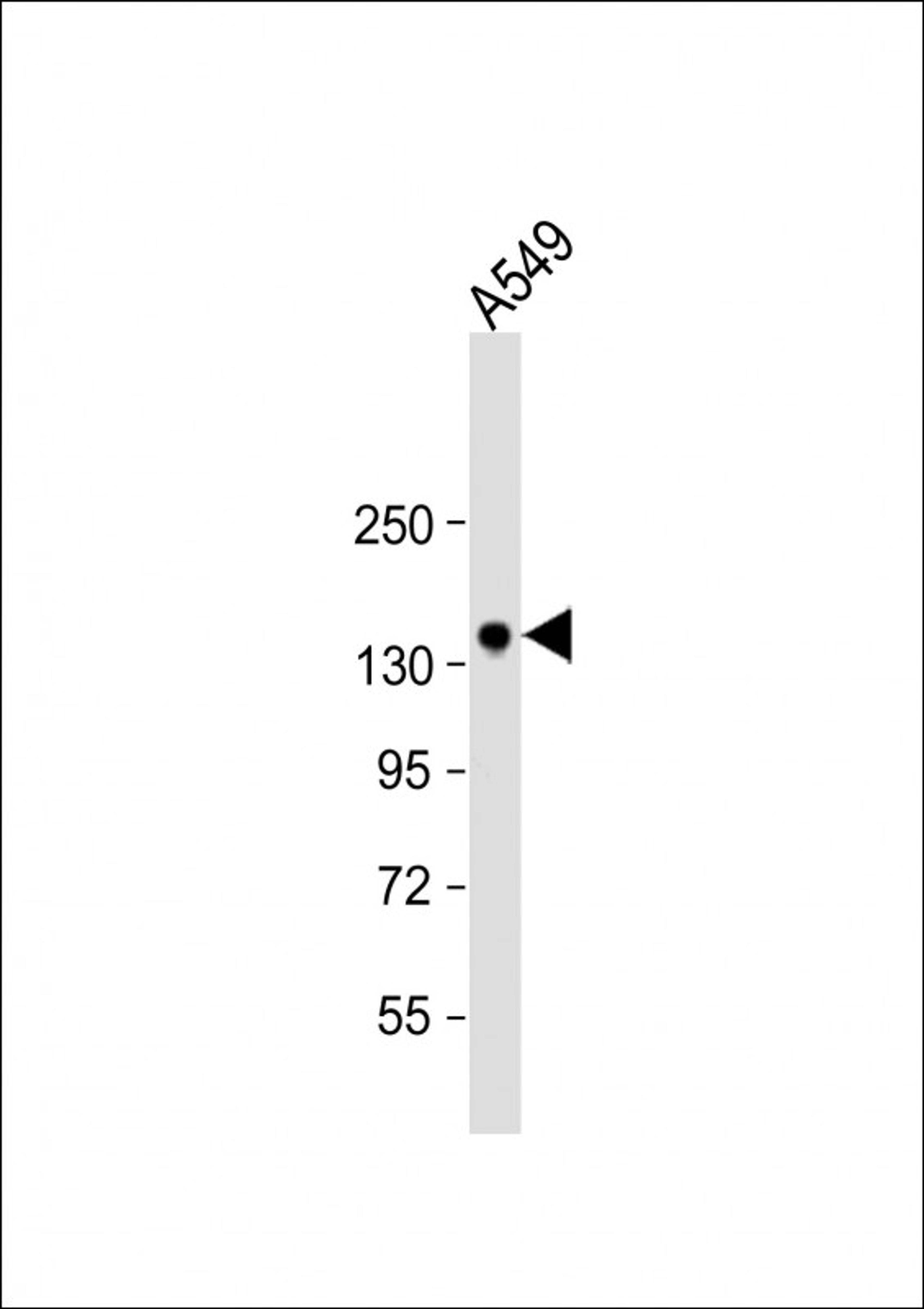 Western Blot at 1:1000 dilution + A549 whole cell lysate Lysates/proteins at 20 ug per lane.