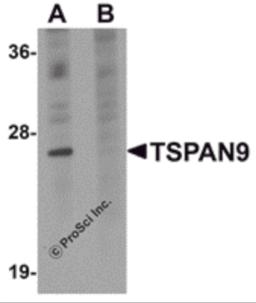 Western blot analysis of TSPAN9 in EL4 cell lysate with TSPAN9 antibody at 1 &#956;g/mL in (A) the absence and (B) the presence of blocking peptide.