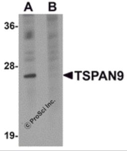 Western blot analysis of TSPAN9 in EL4 cell lysate with TSPAN9 antibody at 1 μg/mL in (A) the absence and (B) the presence of blocking peptide.