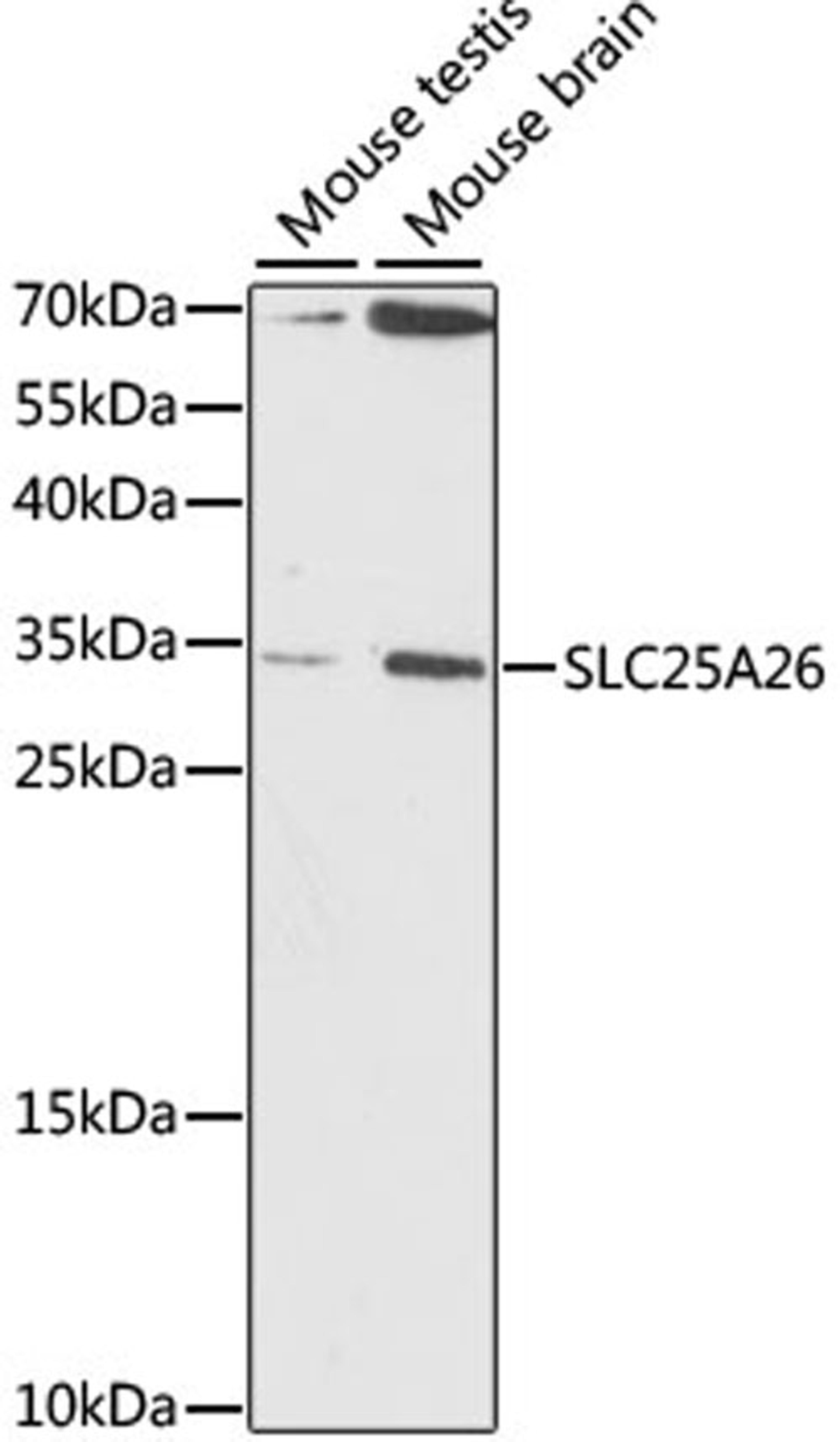 Western blot - SLC25A26 antibody (A15557)