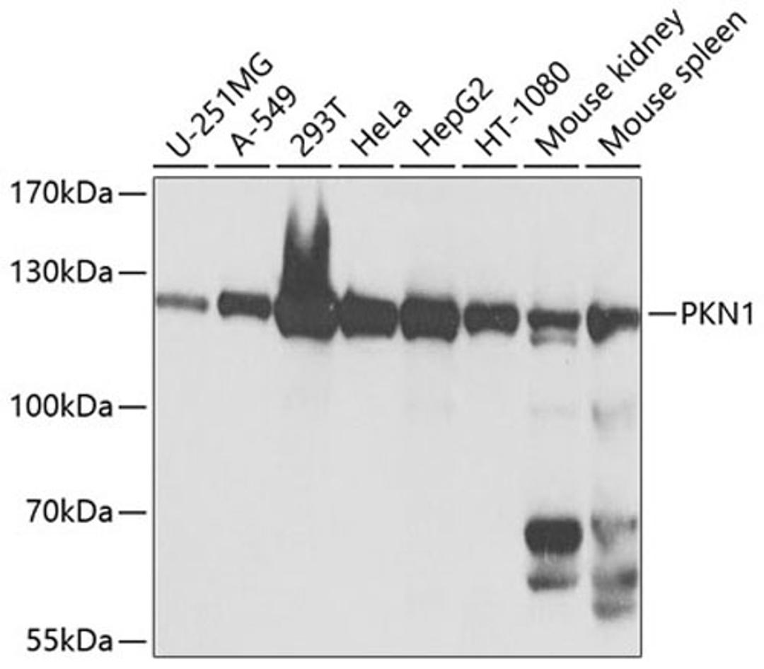 Western blot - PKN1 antibody (A0553)