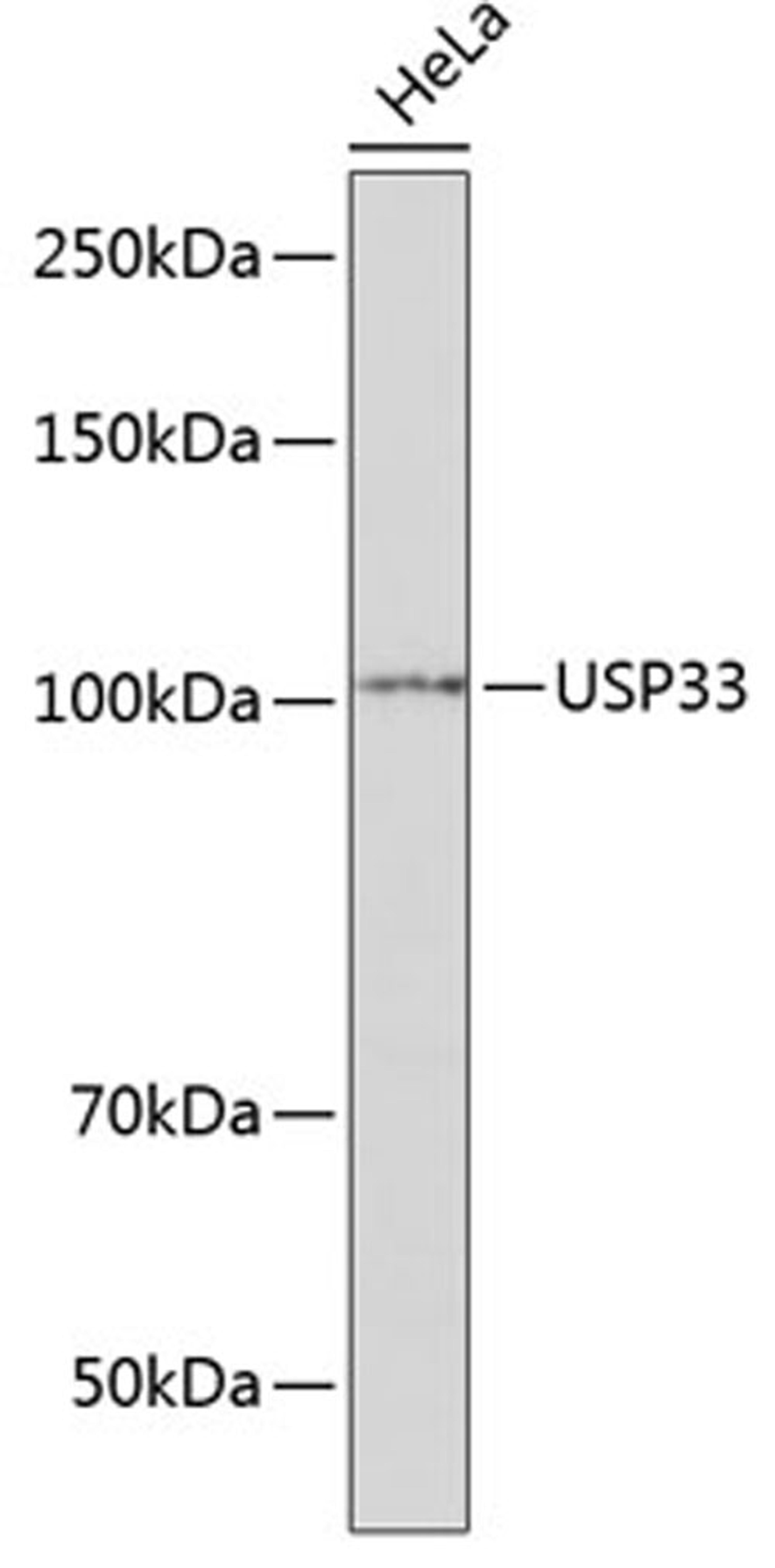 Western blot - USP33 Polyclonal Antibody (A16187)