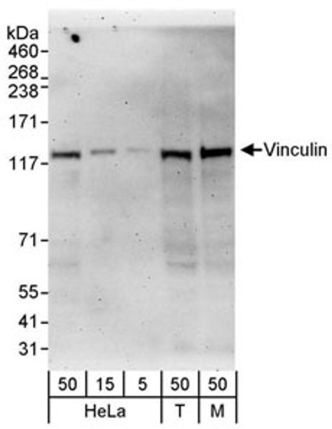 Detection of human and mouse Vinculin by western blot.