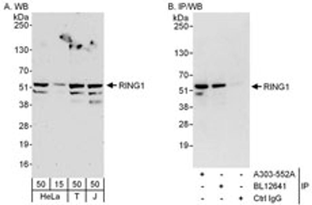 Detection of human RING1 by western blot and immunoprecipitation.