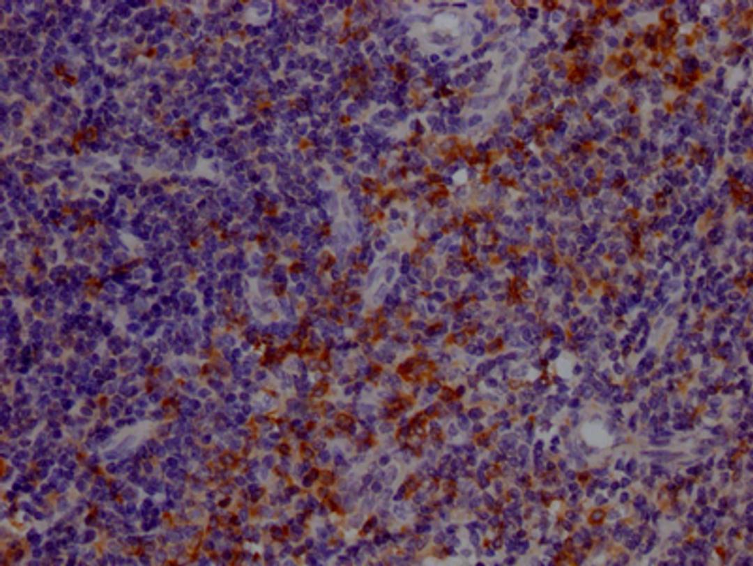 IHC image of CSB-RA556665A0HU diluted at 1:100 and staining in paraffin-embedded human tonsil tissue performed on a Leica BondTM system. After dewaxing and hydration, antigen retrieval was mediated by high pressure in a citrate buffer (pH 6.0). Section was blocked with 10% normal goat serum 30min at RT. Then primary antibody (1% BSA) was incubated at 4℃ overnight. The primary is detected by a Goat anti-rabbit IgG polymer labeled by HRP and visualized using 0.05% DAB.