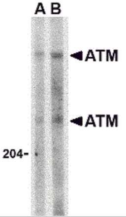 Western blot analysis of ATM in Daudi whole cell lysate with ATM antibody at (A) 1 and (B) 2 &#956;g/mL. 