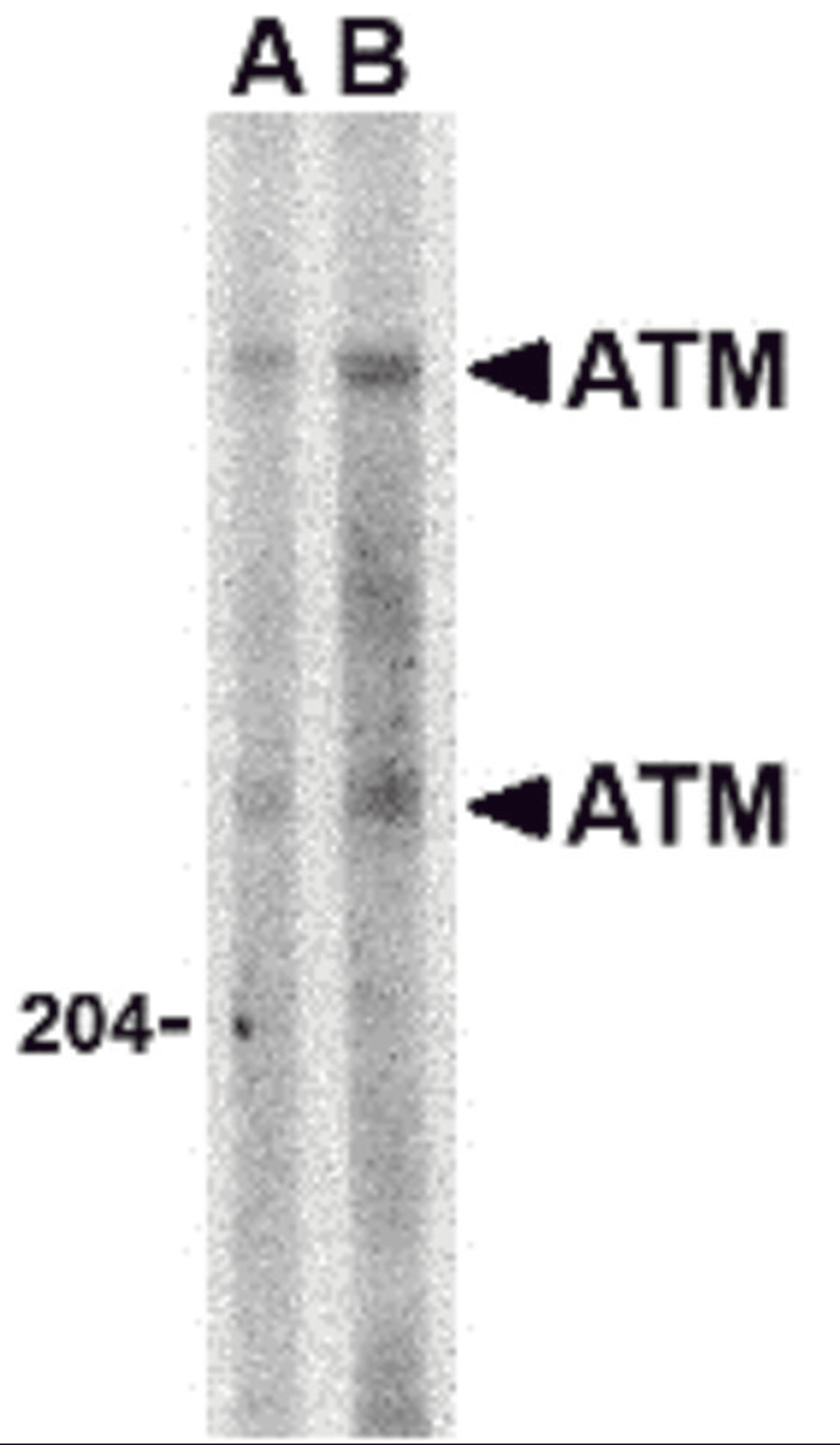 Western blot analysis of ATM in Daudi whole cell lysate with ATM antibody at (A) 1 and (B) 2 &#956;g/mL. 