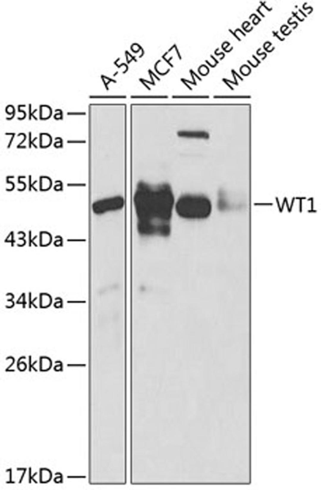 Western blot - WT1 antibody (A1198)