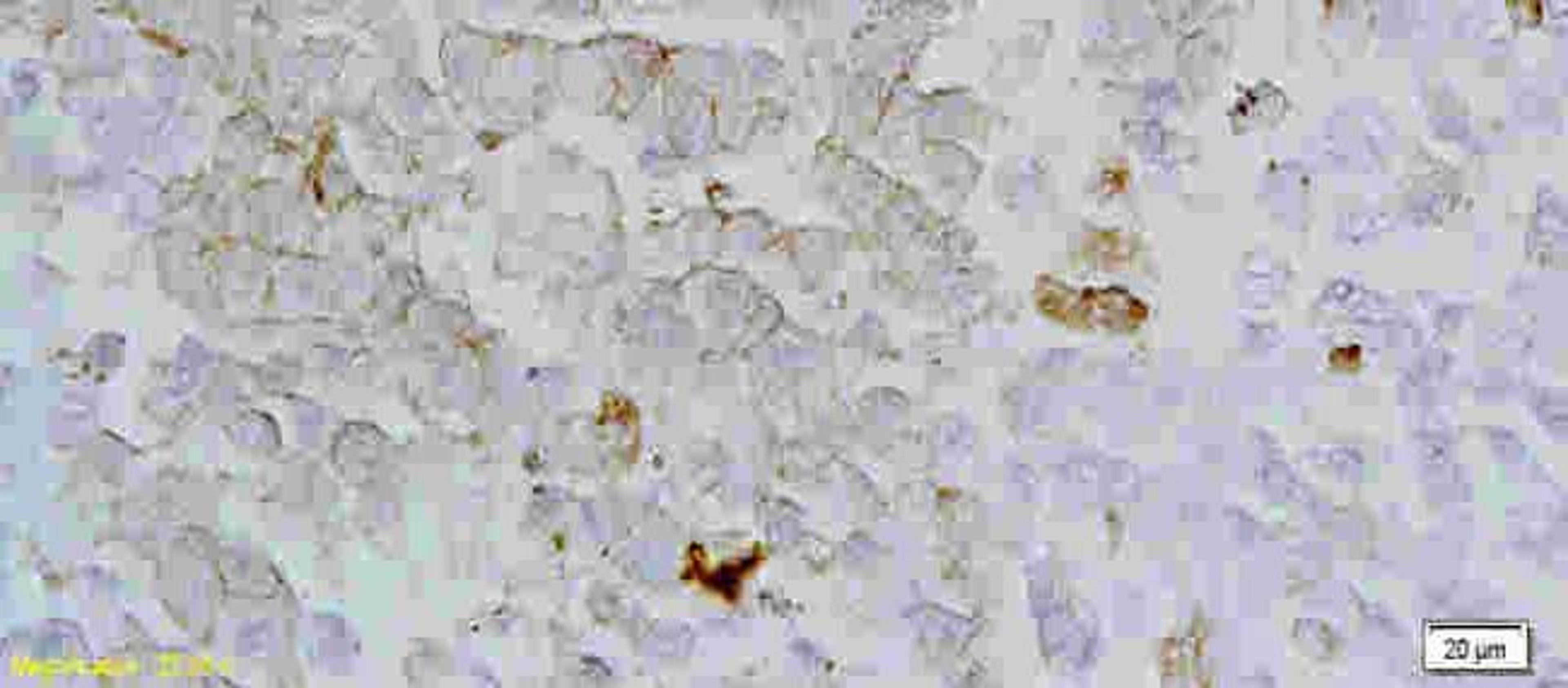 Immunohistochemical analysis of paraffin-embedded rat lung using Kiss1 Receptor antibody.