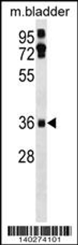 Western blot analysis in mouse bladder tissue lysates (35ug/lane).