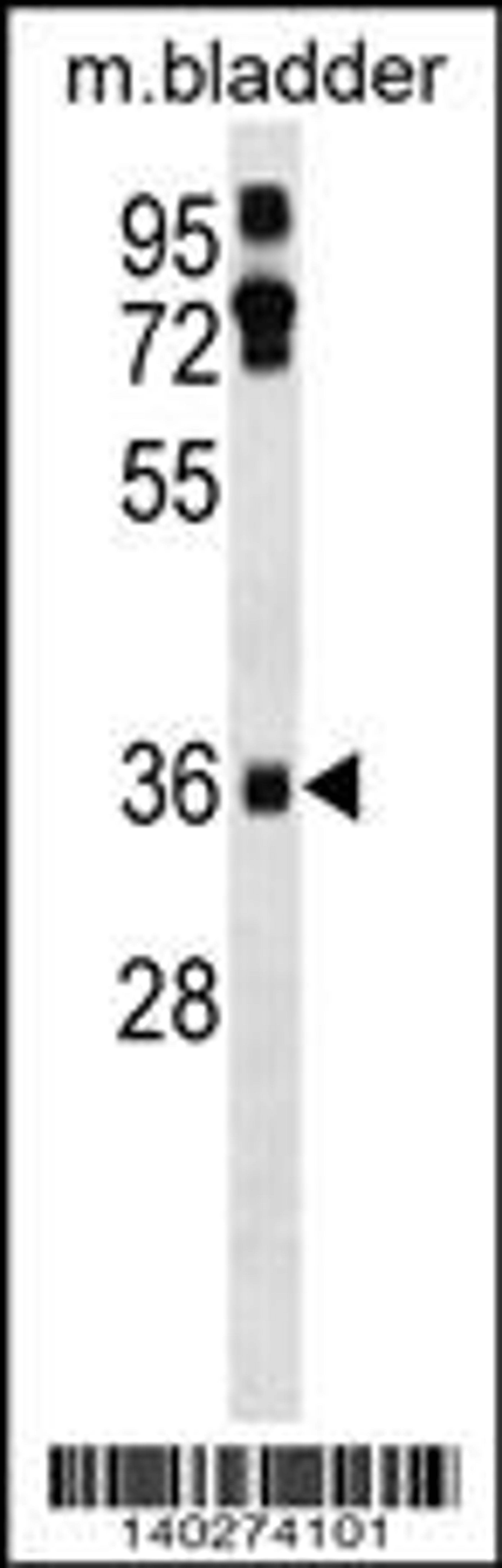 Western blot analysis in mouse bladder tissue lysates (35ug/lane).