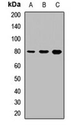 Western blot analysis of mouse heart (Lane1), mouse lung (Lane2), rat liver (Lane3) whole cell lysates using THOP1 antibody