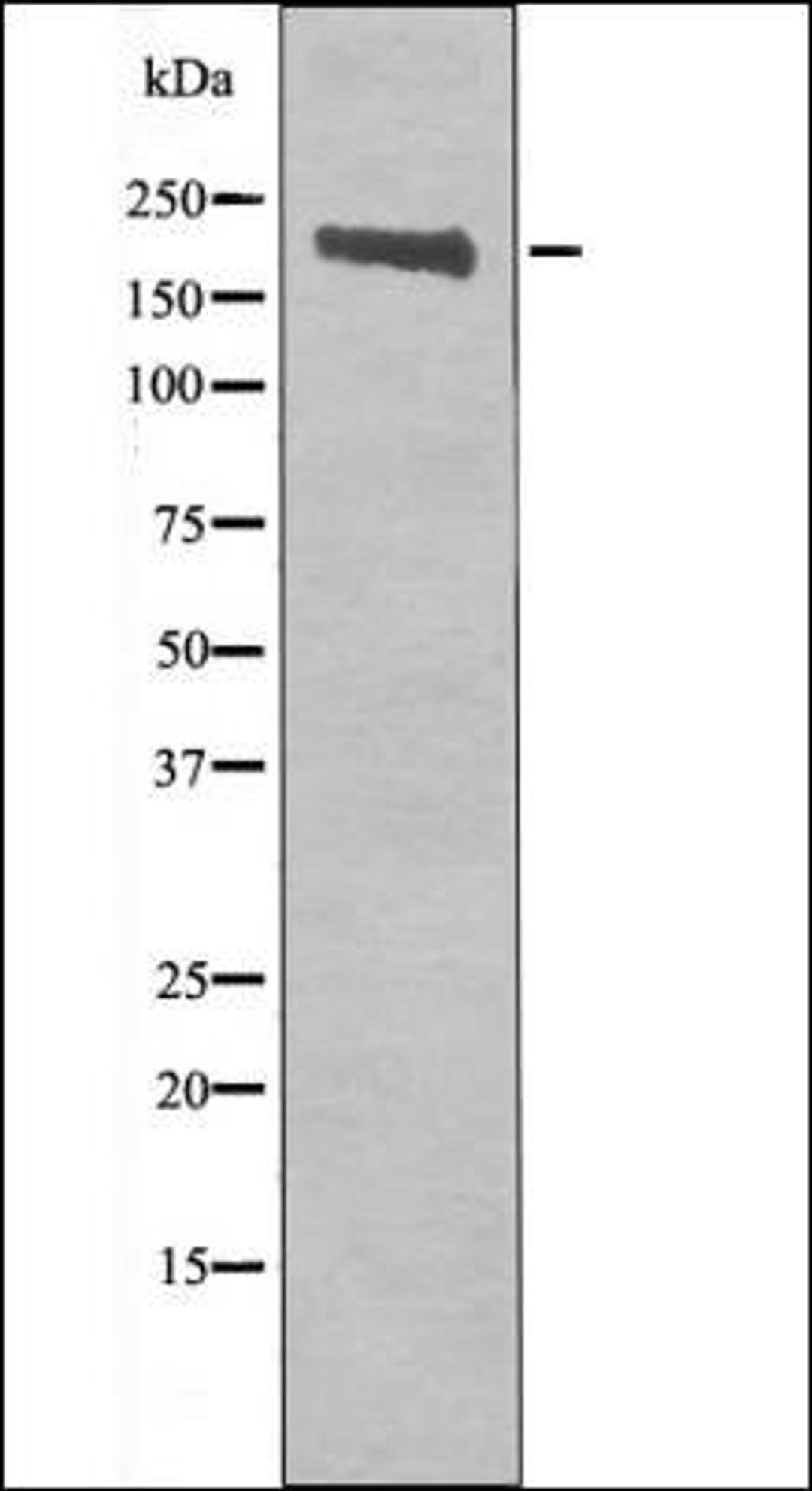 Western blot analysis of COS7 whole cell lysates using Ret -Phospho-Tyr905- antibody