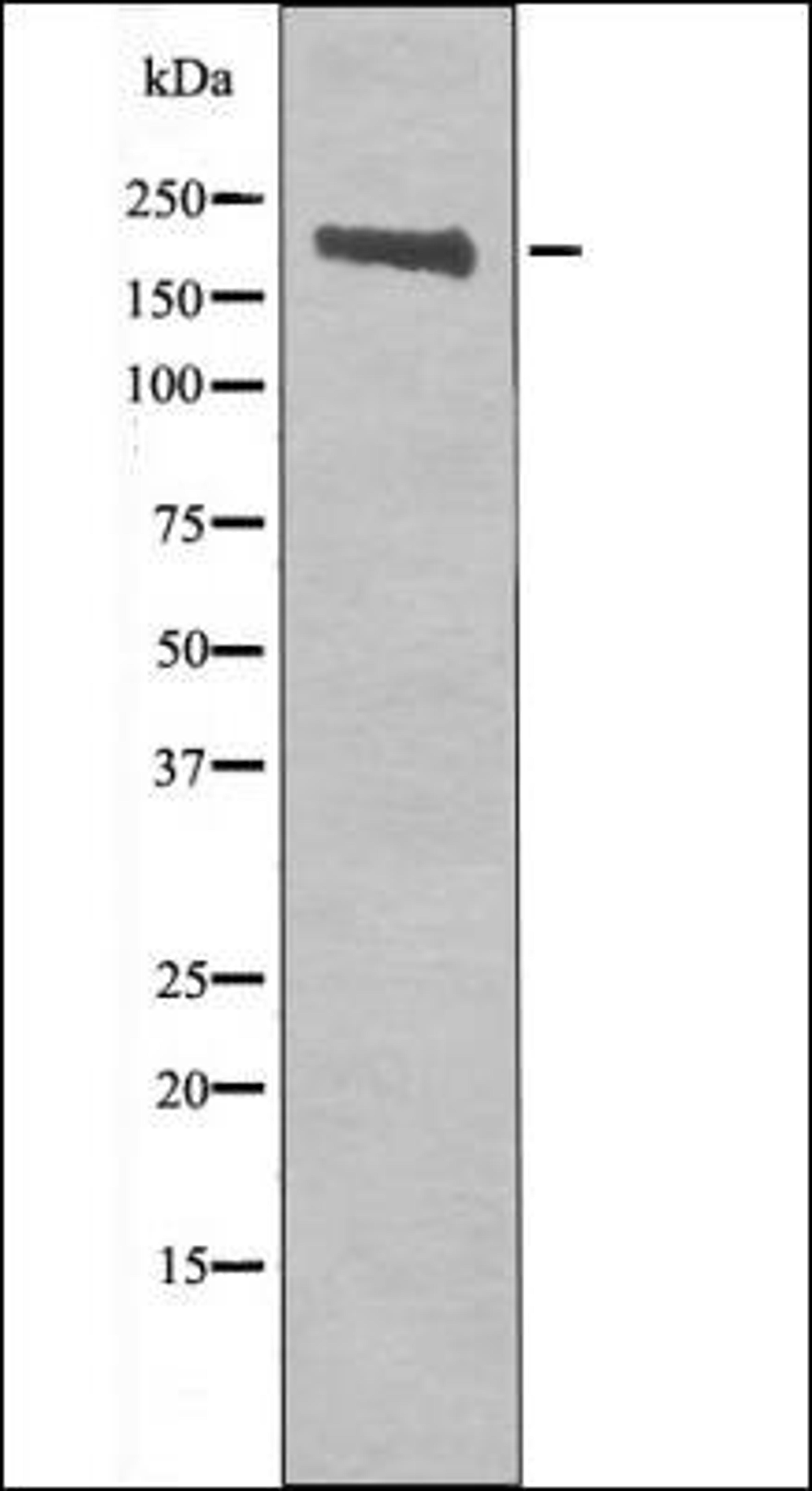 Western blot analysis of COS7 whole cell lysates using Ret -Phospho-Tyr905- antibody