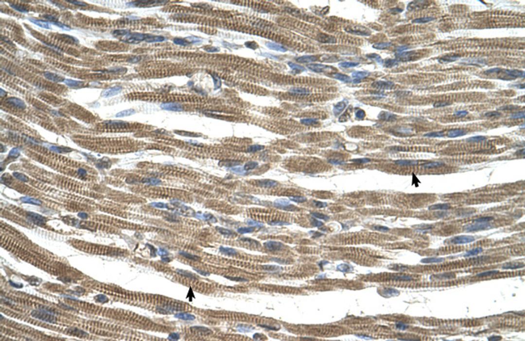 Antibody used in IHC on Human Muscle.