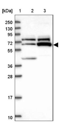 Western Blot: ZNF329 Antibody [NBP1-92622] - Lane 1: Marker [kDa] 250, 130, 95, 72, 55, 36, 28, 17, 10<br/>Lane 2: Human cell line RT-4<br/>Lane 3: Human cell line U-251MG sp