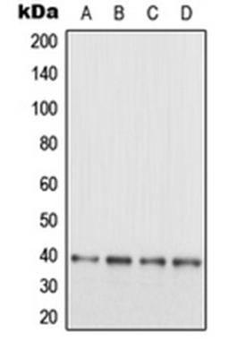 Western blot analysis of SHSY5Y (Lane 1), HeLa (Lane 2), SP2/0 (Lane 3), PC12 (Lane 4) whole cell lysates using MAPRE3 antibody