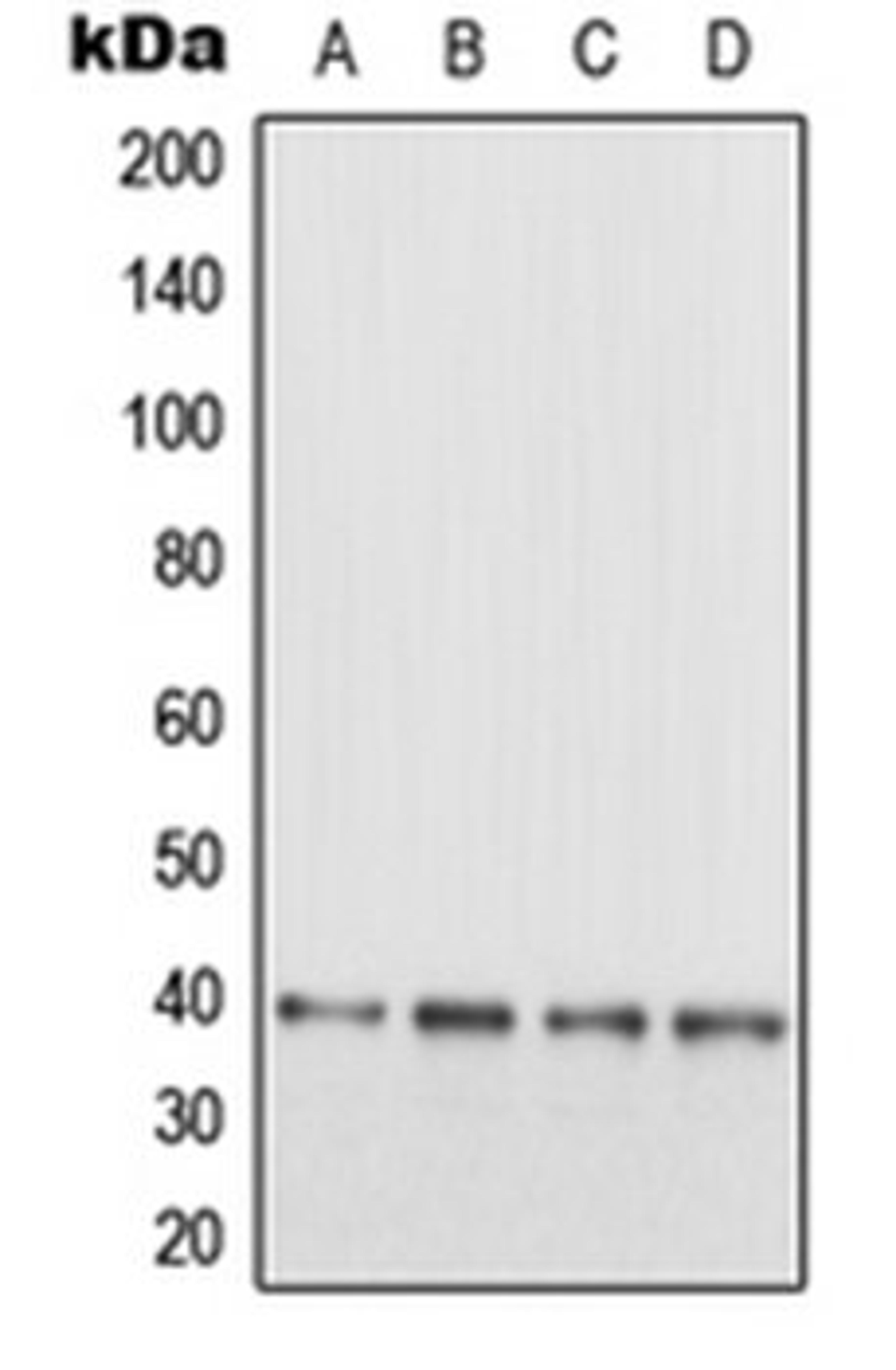 Western blot analysis of SHSY5Y (Lane 1), HeLa (Lane 2), SP2/0 (Lane 3), PC12 (Lane 4) whole cell lysates using MAPRE3 antibody