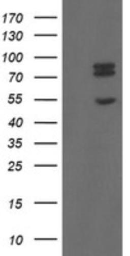 Western Blot: TLE1 Antibody (1H2) [NBP2-46134] - Analysis of HEK293T cells were transfected with the pCMV6-ENTRY control (Left lane) or pCMV6-ENTRY TLE1.