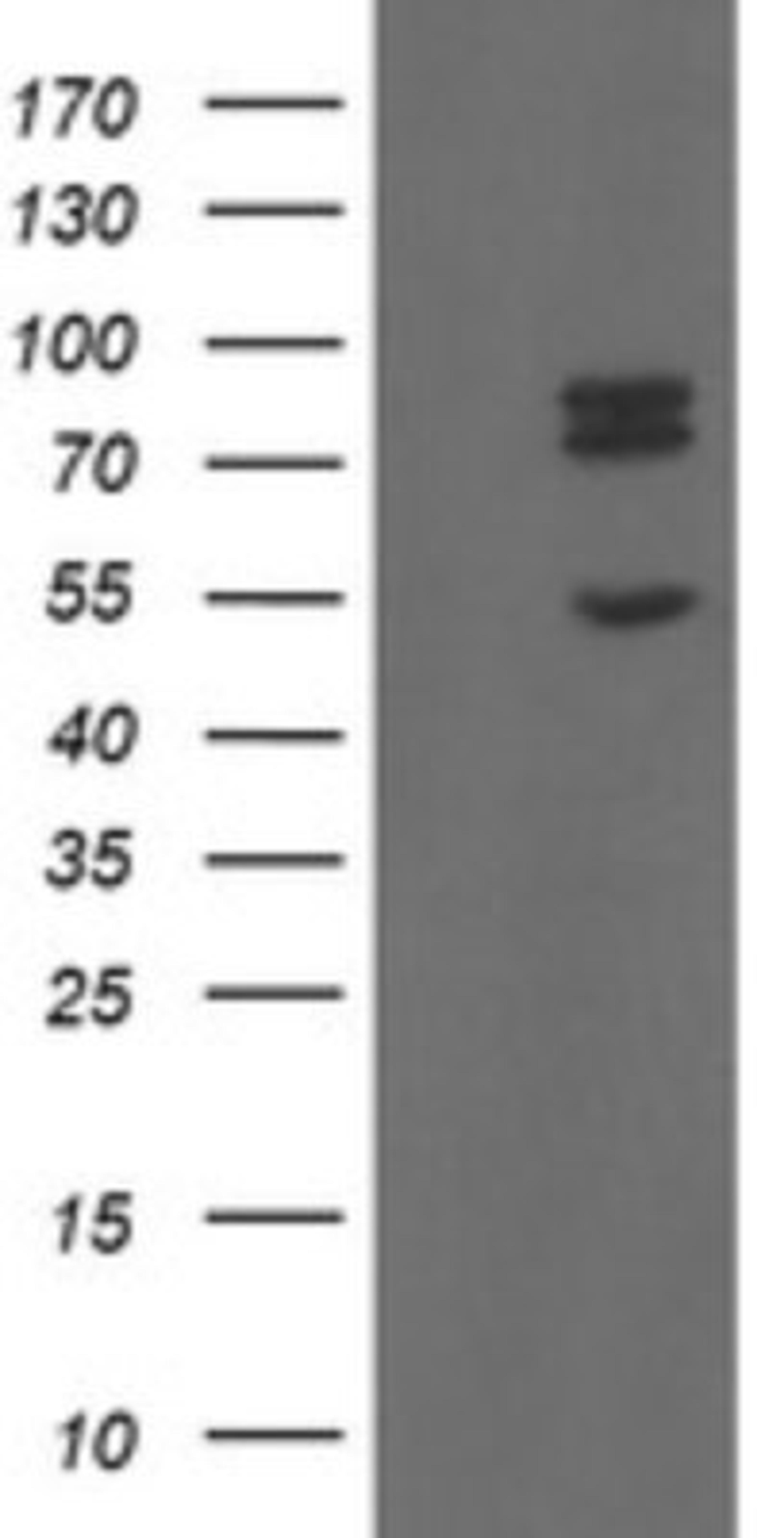 Western Blot: TLE1 Antibody (1H2) [NBP2-46134] - Analysis of HEK293T cells were transfected with the pCMV6-ENTRY control (Left lane) or pCMV6-ENTRY TLE1.