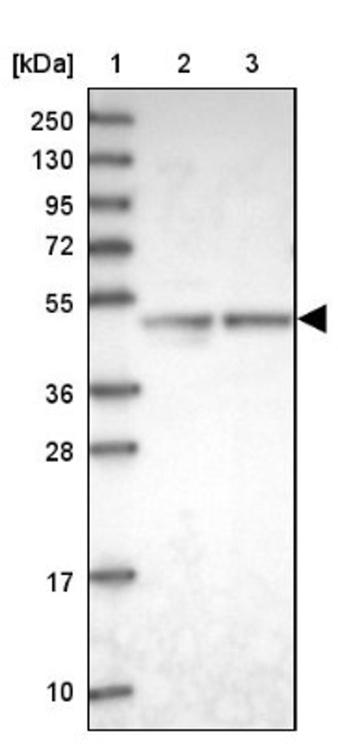 Western Blot: ARMC6 Antibody [NBP2-14317] - Lane 1: Marker [kDa] 250, 130, 95, 72, 55, 36, 28, 17, 10<br/>Lane 2: Human cell line RT-4<br/>Lane 3: Human cell line U-251MG sp