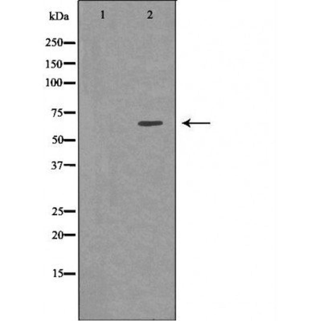 Western blot analysis of PC3 cell lines using KBTBD3 antibody