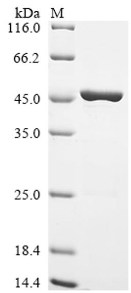 (Tris-Glycine gel) Discontinuous SDS-PAGE (reduced) with 5% enrichment gel and 15% separation gel.