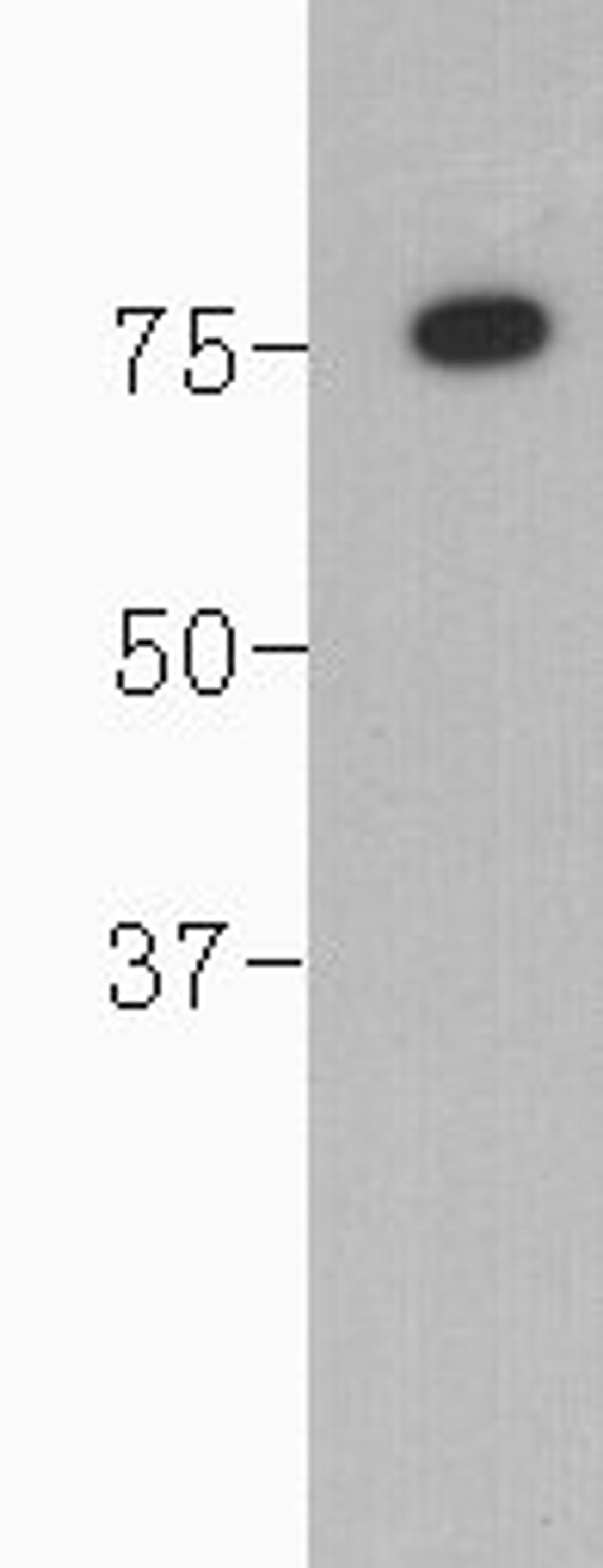 Western Blot analysis of human serum using Complement C4 beta chain antibody