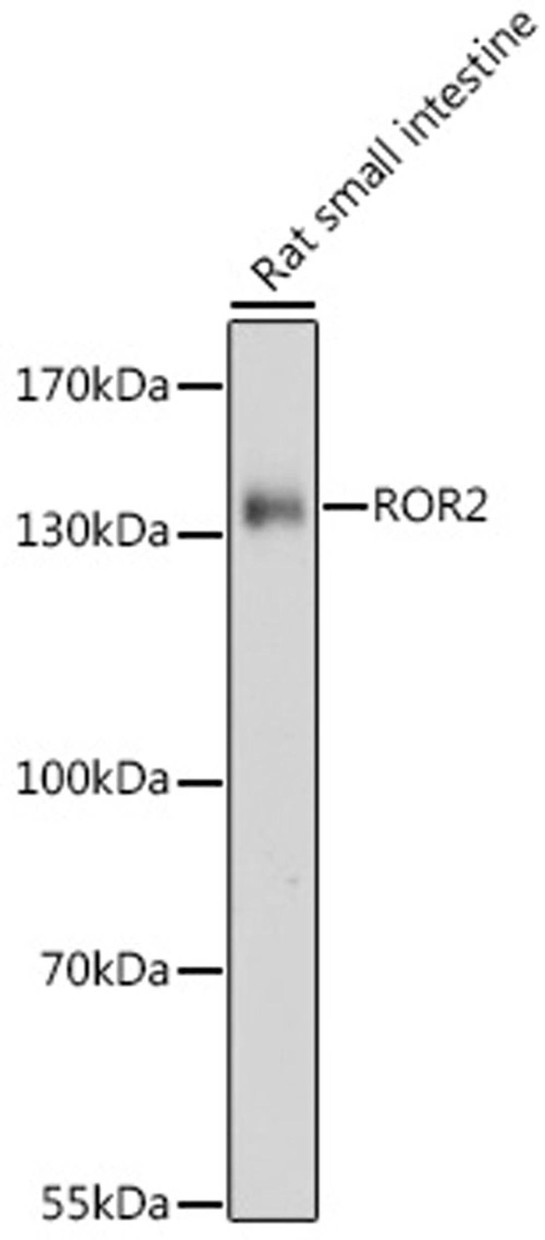 Western blot - ROR2 antibody (A17331)