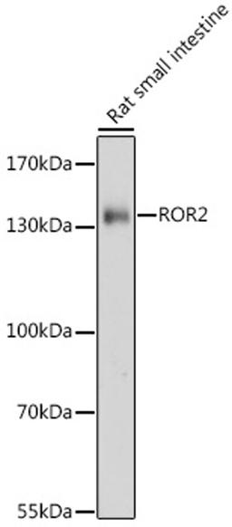 Western blot - ROR2 antibody (A17331)