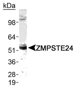 Western Blot: ZMPSTE24 Antibody [NB100-2387] - Detection of ZMPSTE24 in human testis.