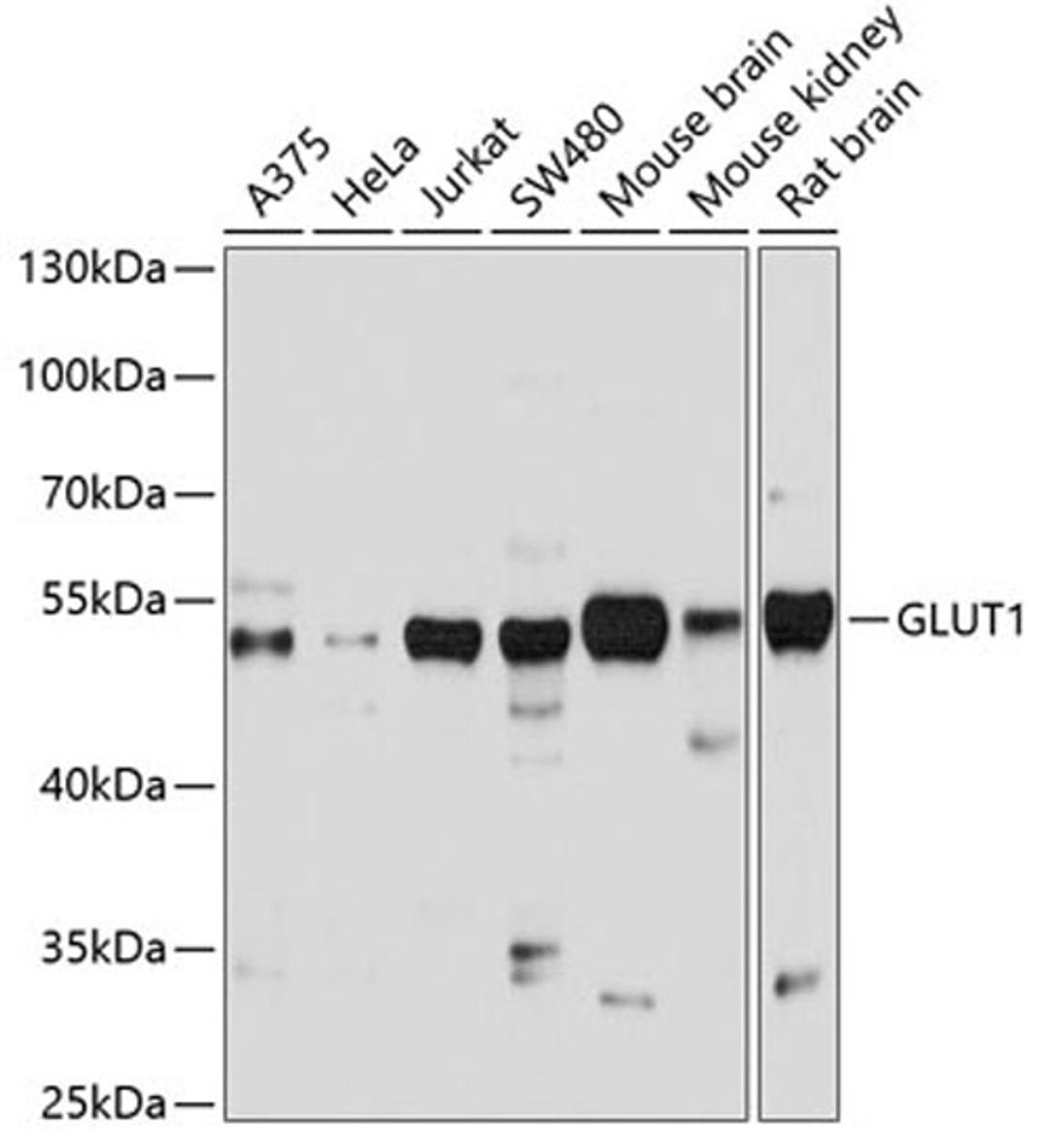 Western blot - GLUT1 antibody (A6982)