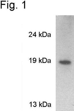 Western Blot: VAMP-2 Antibody [NB300-595] - Analysis of rat brain extract.