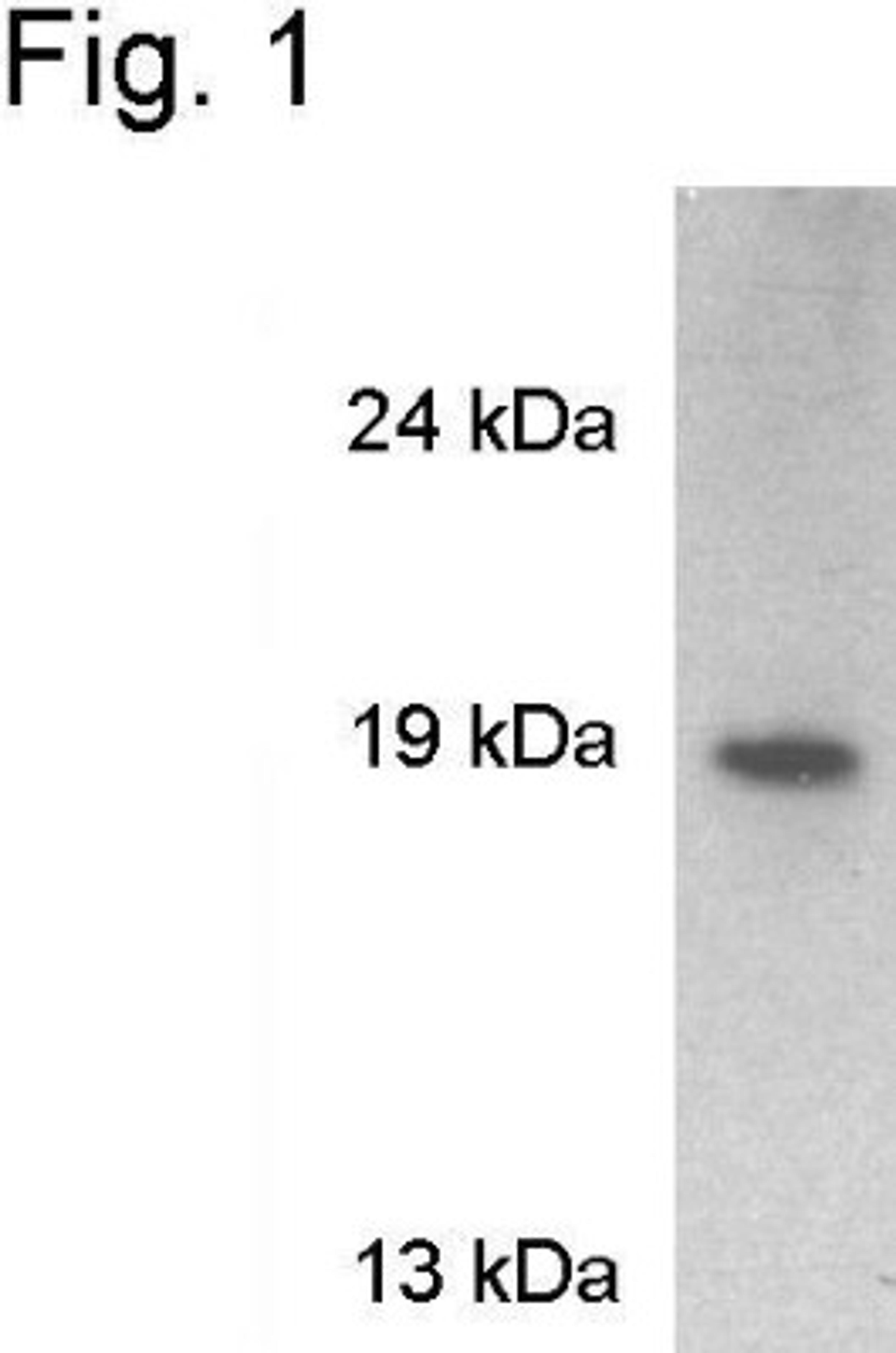 Western Blot: VAMP-2 Antibody [NB300-595] - Analysis of rat brain extract.