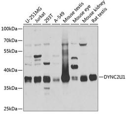 Western blot - DYNC2LI1 antibody (A4752)