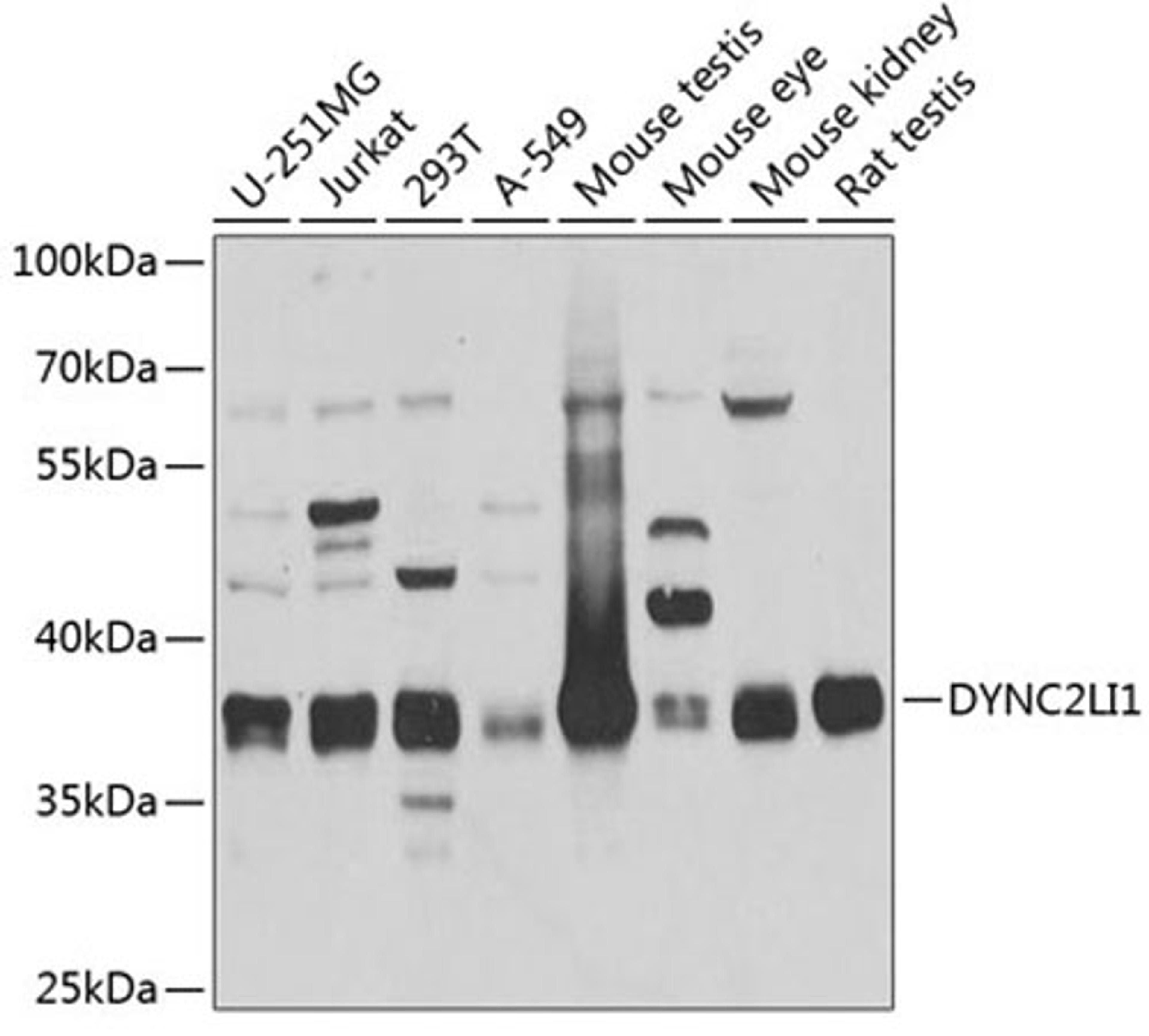 Western blot - DYNC2LI1 antibody (A4752)