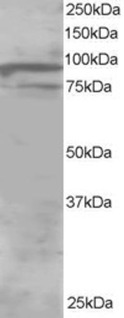 46-107 staining (1ug/ml) of Human Brain lysate (RIPA buffer, 30ug total protein per lane). Primary incubated for 1 hour. Detected by western blot using chemiluminescence.