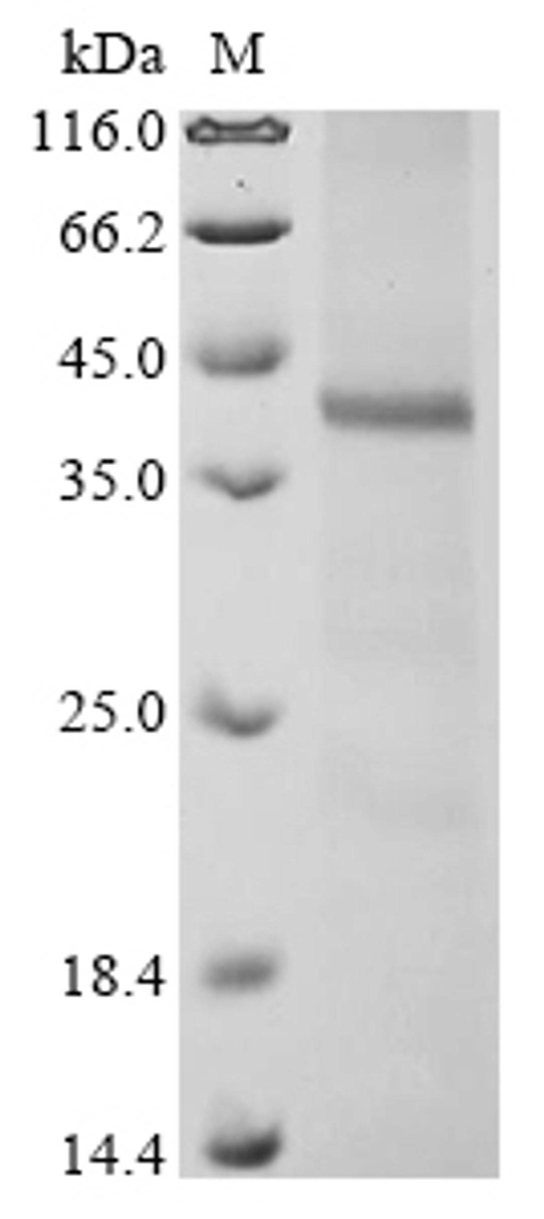 (Tris-Glycine gel) Discontinuous SDS-PAGE (reduced) with 5% enrichment gel and 15% separation gel.