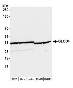 Detection of human and mouse GLOD4 by WB.