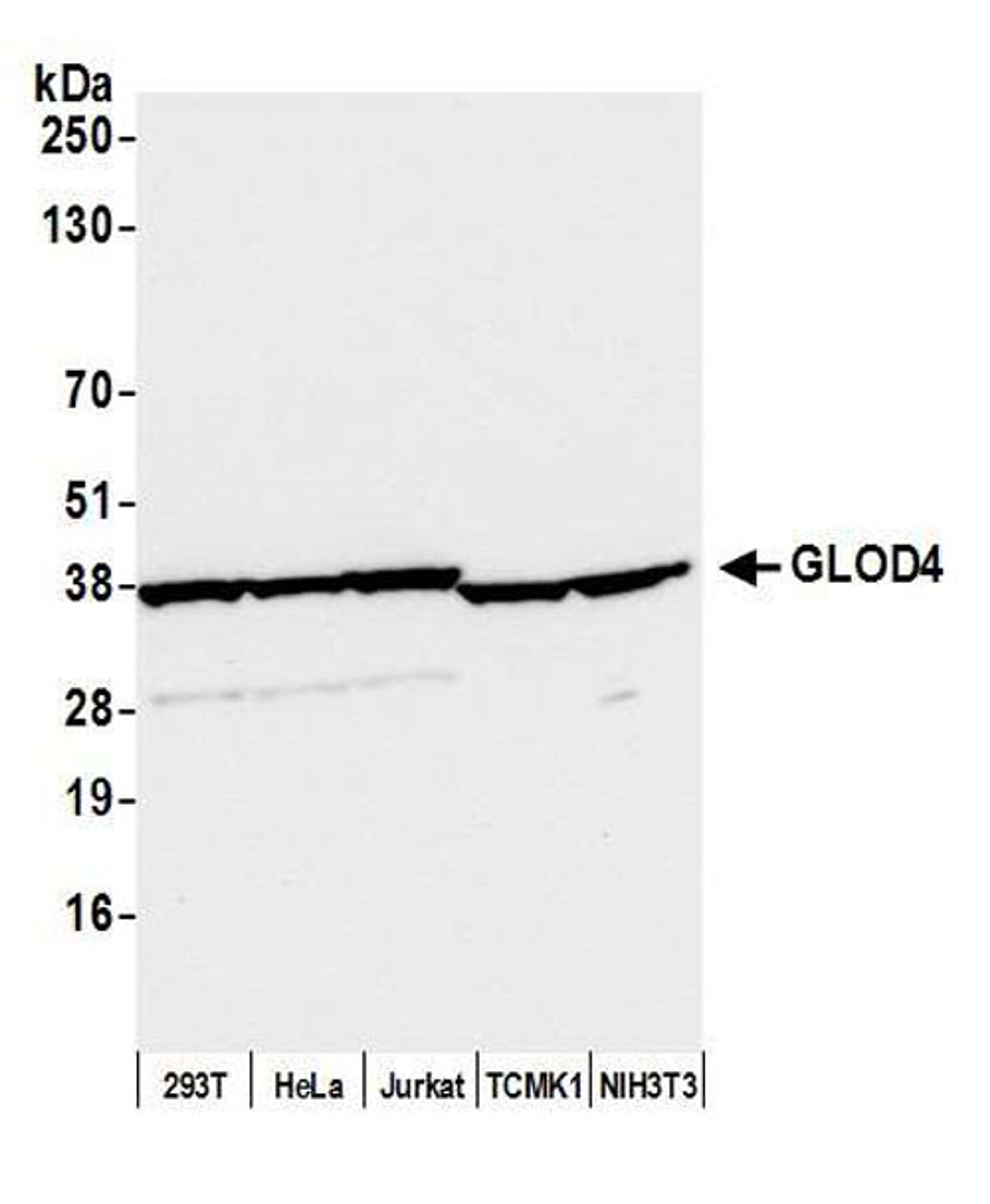 Detection of human and mouse GLOD4 by WB.