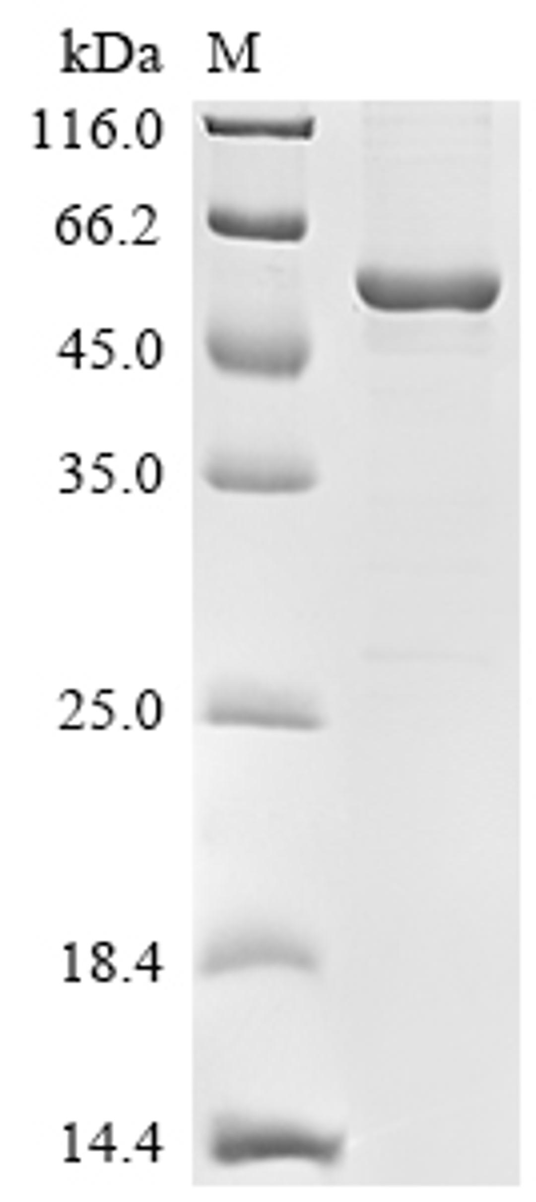 (Tris-Glycine gel) Discontinuous SDS-PAGE (reduced) with 5% enrichment gel and 15% separation gel.