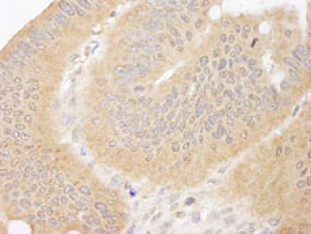 Detection of human CC2D1A by immunohistochemistry.