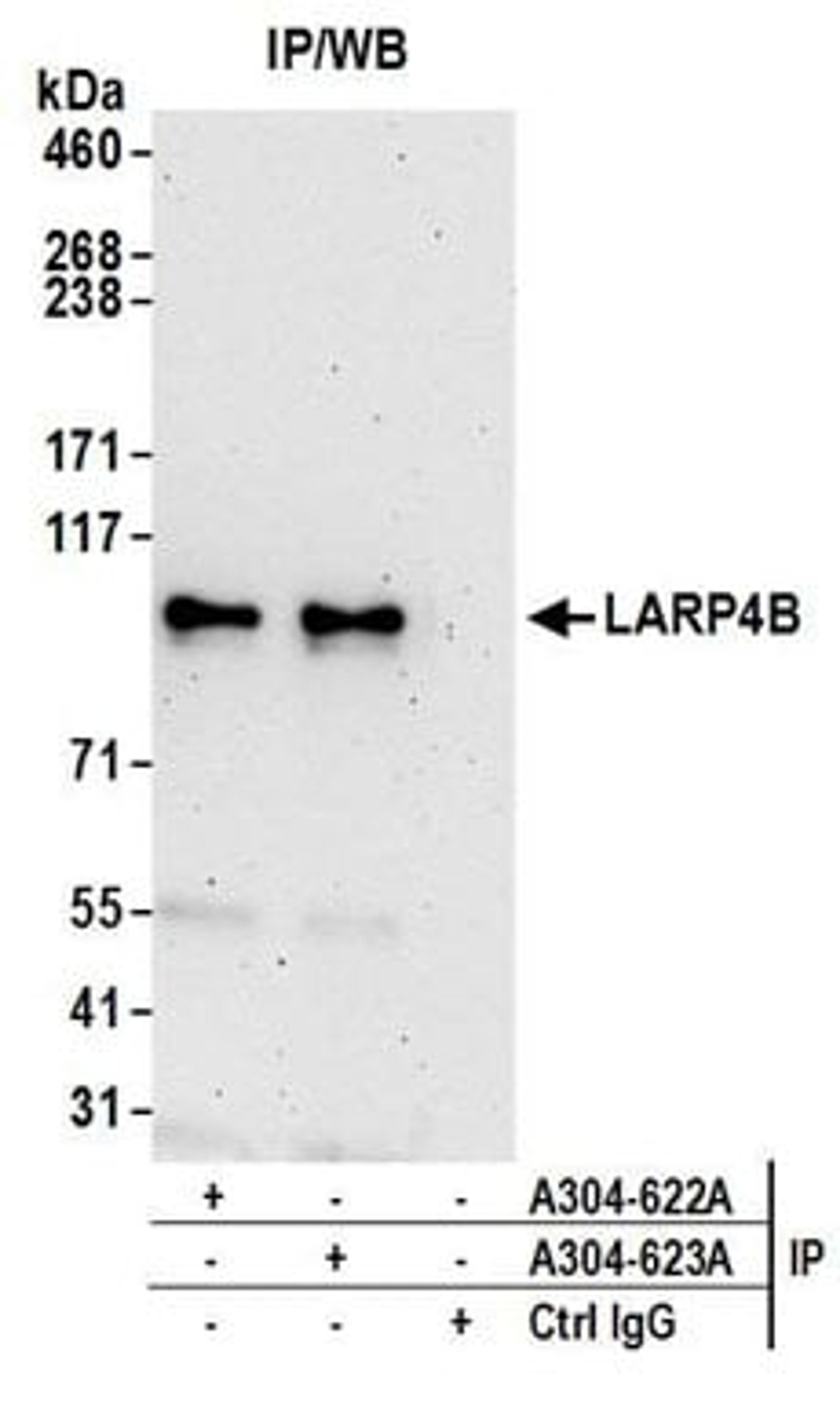 Detection of human LARP4B by western blot of immunoprecipitates.