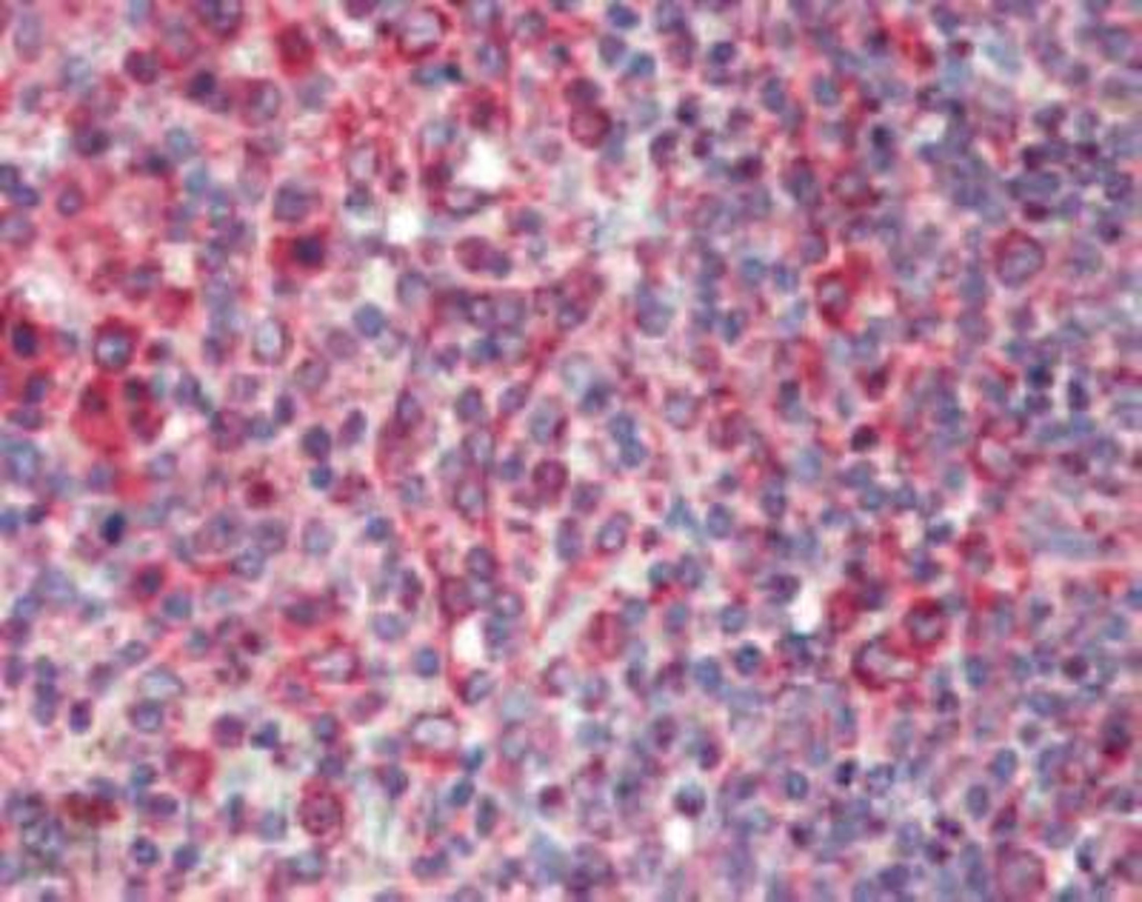 Immunohistochemistry-Paraffin: Calnexin Antibody [NBP1-97485] - Analysis of human spleen tissue stained with Calnexin, pAb at 10ug/ml.